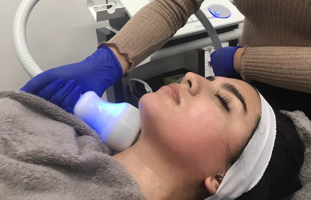 4 CryoThermal Facials (T-Shock) Face/Neck or Neck/Declotte