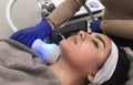4 CryoThermal Facials (T-Shock) Face/Neck or Neck/Declotte